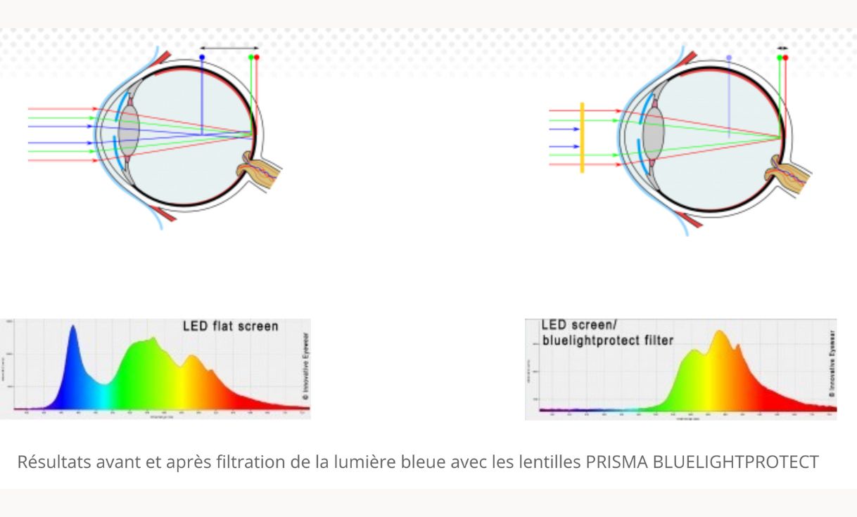 Fonctionnement de filtration des lunettes Prisma (Aberration chromatique)